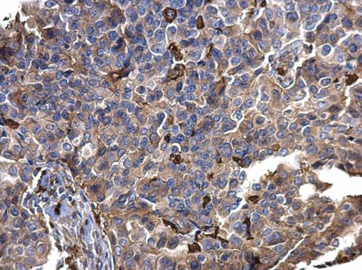 Immunohistochemistry (Formalin/PFA-fixed paraffin-embedded sections) - Anti-S100A9 antibody (AB227924), expandable thumbnail