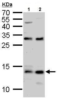 Western blot - Anti-S100A9 antibody (AB227924), expandable thumbnail