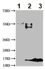 Immunoprecipitation - Anti-S100A9 antibody (AB234989), expandable thumbnail