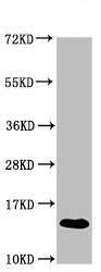 Western blot - Anti-S100A9 antibody (AB234989), expandable thumbnail