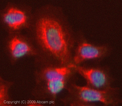 Immunocytochemistry/ Immunofluorescence - Anti-S100A9 antibody (AB63818), expandable thumbnail