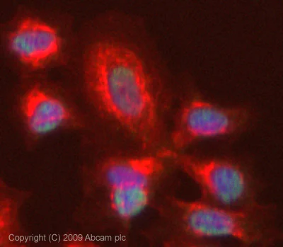 Immunocytochemistry/ Immunofluorescence - Anti-S100A9 antibody (AB63818)
