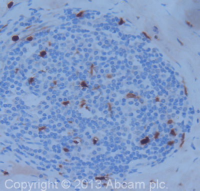 Immunohistochemistry (Formalin/PFA-fixed paraffin-embedded sections) - Anti-S100A9 antibody (AB63818), expandable thumbnail