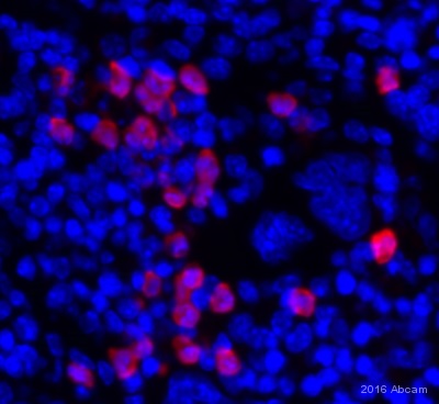 Immunohistochemistry (Formalin/PFA-fixed paraffin-embedded sections) - Anti-S100A9 antibody (AB63818), expandable thumbnail