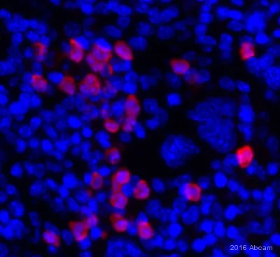 Immunohistochemistry (Formalin/PFA-fixed paraffin-embedded sections) - Anti-S100A9 antibody (AB63818)