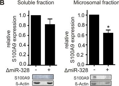 Western blot - Anti-S100A9 antibody (ab63818), expandable thumbnail