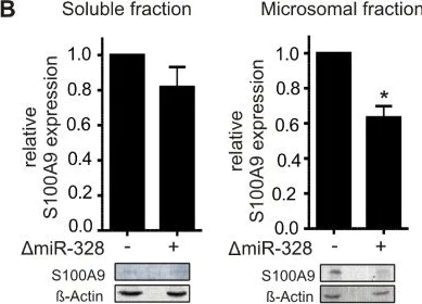 Western blot - Anti-S100A9 antibody (AB63818)