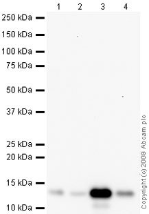 Western blot - Anti-S100A9 antibody (AB63818), expandable thumbnail