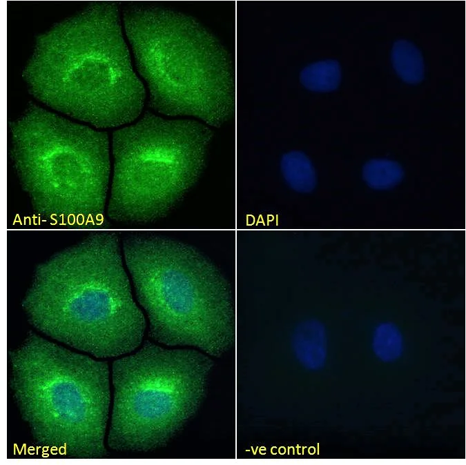 Immunocytochemistry - Anti-S100A9 antibody (AB81522)