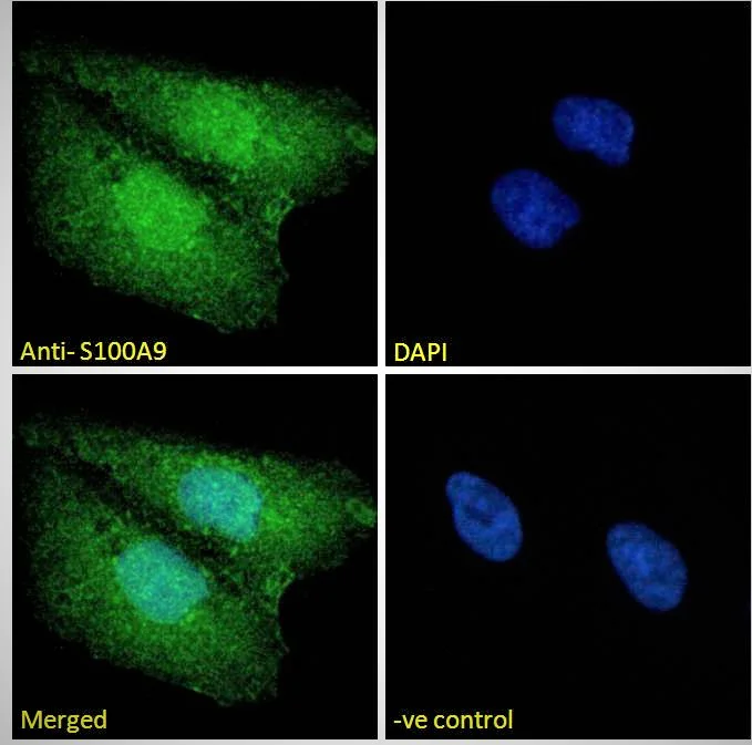 Immunocytochemistry - Anti-S100A9 antibody (AB81522)