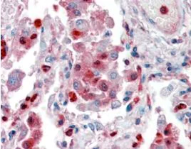 Immunohistochemistry (Formalin/PFA-fixed paraffin-embedded sections) - Anti-S100A9 antibody (AB81522)
