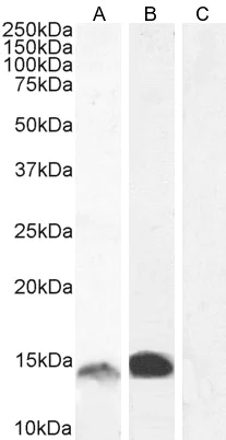 Western blot - Anti-S100A9 antibody (AB81522)