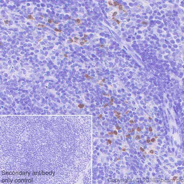 Immunohistochemistry (Formalin/PFA-fixed paraffin-embedded sections) - Anti-S100A9 antibody [EPR22332-75] - BSA and Azide free (AB243108)