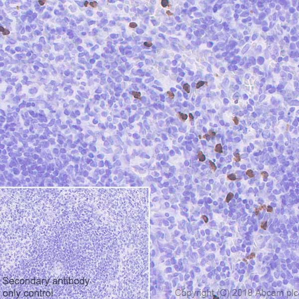 Immunohistochemistry (Formalin/PFA-fixed paraffin-embedded sections) - Anti-S100A9 antibody [EPR22332-75] - BSA and Azide free (AB243108)