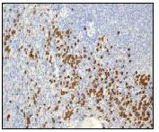Immunohistochemistry (Formalin/PFA-fixed paraffin-embedded sections) - Anti-S100A9 antibody [EPR3556] (AB92468), expandable thumbnail