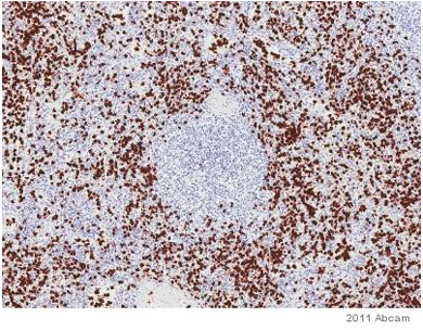 Immunohistochemistry (Formalin/PFA-fixed paraffin-embedded sections) - Anti-S100A9 + Calprotectin (S100A8/A9 complex) antibody [MAC387] (AB22506), expandable thumbnail