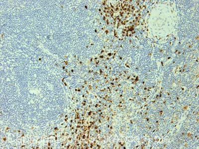 Immunohistochemistry (Formalin/PFA-fixed paraffin-embedded sections) - Anti-S100A9 + Calprotectin (S100A8/A9 complex) antibody [MAC387] (AB22506)