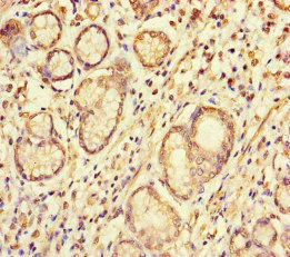 Immunohistochemistry (Formalin/PFA-fixed paraffin-embedded sections) - Anti-S100G antibody (AB234678)