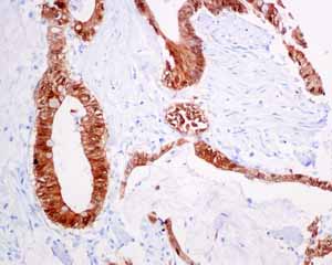Immunohistochemistry (Formalin/PFA-fixed paraffin-embedded sections) - Anti-S100P antibody [EPR6142] (AB124743)