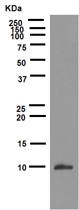 Western blot - Anti-S100P antibody [EPR6142] (AB124743)