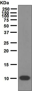 Western blot - Anti-S100P antibody [EPR6142] (AB124743)