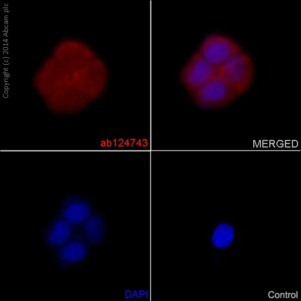 Immunocytochemistry/ Immunofluorescence - Anti-S100P antibody [EPR6142] - BSA and Azide free (AB246341)
