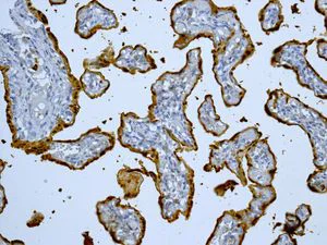 Immunohistochemistry (Formalin/PFA-fixed paraffin-embedded sections) - Anti-S100P antibody [EPR6142] - BSA and Azide free (AB246341)