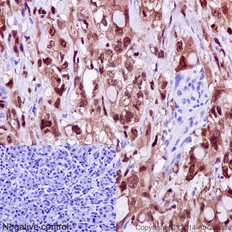 Immunohistochemistry (Formalin/PFA-fixed paraffin-embedded sections) - Anti-S100P antibody [EPR6142] - BSA and Azide free (AB246341)