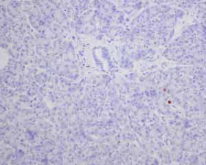 Immunohistochemistry (Formalin/PFA-fixed paraffin-embedded sections) - Anti-S100P antibody [EPR6142] - BSA and Azide free (AB246341)