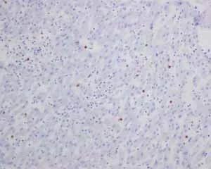 Immunohistochemistry (Formalin/PFA-fixed paraffin-embedded sections) - Anti-S100P antibody [EPR6142] - BSA and Azide free (AB246341)