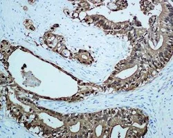 Immunohistochemistry (Formalin/PFA-fixed paraffin-embedded sections) - Anti-S100P antibody [EPR6142] - BSA and Azide free (AB246341)