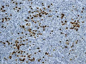 Immunohistochemistry (Formalin/PFA-fixed paraffin-embedded sections) - Anti-S100P antibody [EPR6142] - BSA and Azide free (AB246341)