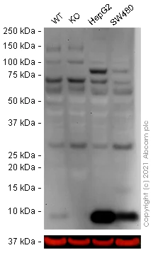 Western blot - Anti-S100P antibody [EPR6142] - BSA and Azide free (AB246341)