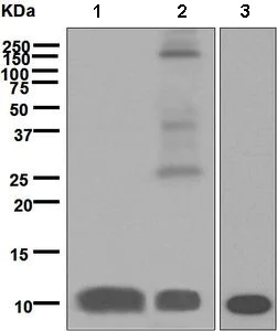 Western blot - Anti-S100P antibody [EPR6143] (AB133554)