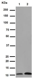 Western blot - Anti-S100P antibody [EPR6143] (AB133554)