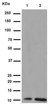 Western blot - Anti-S100P antibody [EPR6143] (AB133554)