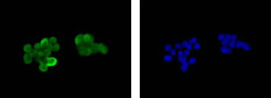 Immunocytochemistry/ Immunofluorescence - Anti-S100P antibody [EPR6143] - BSA and Azide free (AB225543)