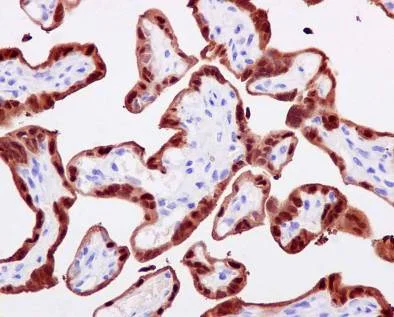 Immunohistochemistry (Formalin/PFA-fixed paraffin-embedded sections) - Anti-S100P antibody [EPR6143] - BSA and Azide free (AB225543)