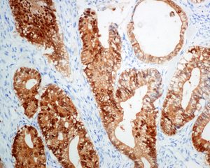 Immunohistochemistry (Formalin/PFA-fixed paraffin-embedded sections) - Anti-S100P antibody [EPR6143] - BSA and Azide free (AB225543), expandable thumbnail