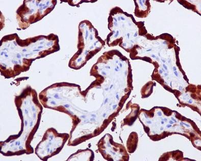 Immunohistochemistry (Formalin/PFA-fixed paraffin-embedded sections) - Anti-S100P antibody [EPR6143] - BSA and Azide free (AB225543), expandable thumbnail