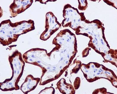 Immunohistochemistry (Formalin/PFA-fixed paraffin-embedded sections) - Anti-S100P antibody [EPR6143] - BSA and Azide free (AB225543)