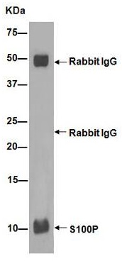 Immunoprecipitation - Anti-S100P antibody [EPR6143] - BSA and Azide free (ab225543), expandable thumbnail