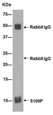 Immunoprecipitation - Anti-S100P antibody [EPR6143] - BSA and Azide free (AB225543)