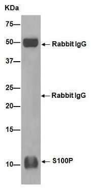 Immunoprecipitation - Anti-S100P antibody [EPR6143] - BSA and Azide free (ab225543), expandable thumbnail