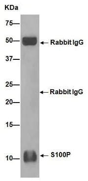 Immunoprecipitation - Anti-S100P antibody [EPR6143] - BSA and Azide free (AB225543)