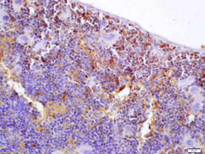 Immunohistochemistry (Formalin/PFA-fixed paraffin-embedded sections) - Anti-S100P binding protein antibody (AB203689)
