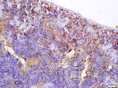 Immunohistochemistry (Formalin/PFA-fixed paraffin-embedded sections) - Anti-S100P binding protein antibody (AB203689)