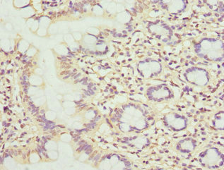 Immunohistochemistry (Formalin/PFA-fixed paraffin-embedded sections) - Anti-S1P antibody - C-terminal (AB224618)