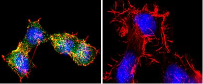 Immunocytochemistry - Anti-S1P1/EDG1 antibody (AB11424)