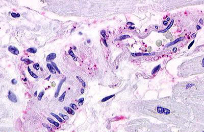 Immunohistochemistry (Formalin/PFA-fixed paraffin-embedded sections) - Anti-S1P1/EDG1 antibody (AB140952)